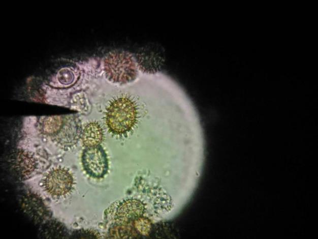 圖4、菌肉內成熟的子囊孢子。