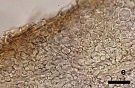 e為菌肉內擬薄壁組織50 μm