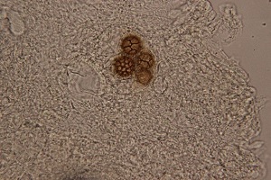 小西氏石櫟松露菌肉內成熟的子囊及子囊孢子 子囊孢子呈現白松露特有的龜紋狀紋路